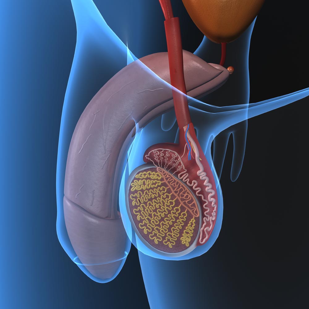 Vazectomia és prostatitis does low t cause prostate cancer